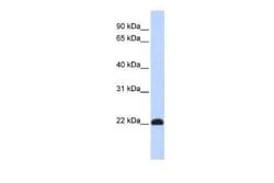 KLF16 Rabbit anti-Human, Polyclonal, Novus Biologicals 100 &mu;g; Unconjugated:Antibodies,